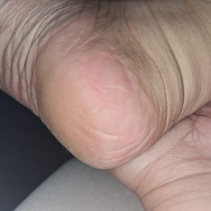 15 stk Fræk billedeserie