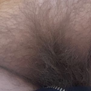 Pussy hair