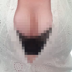 5 Stk. Pirrende billeder