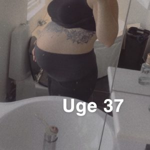 Snap