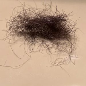 Intim hår fra min mand eller mig