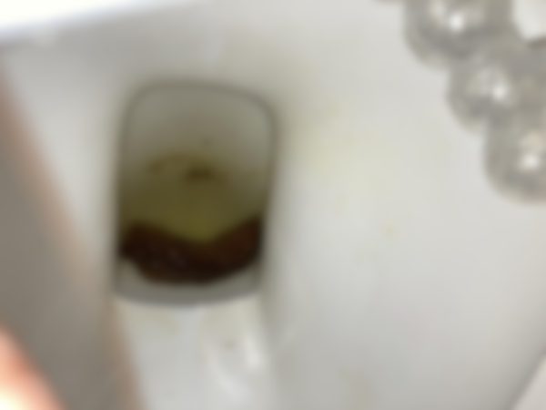 Scat & tis