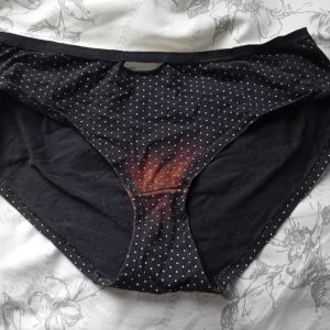 Gamel trus med pletblødning