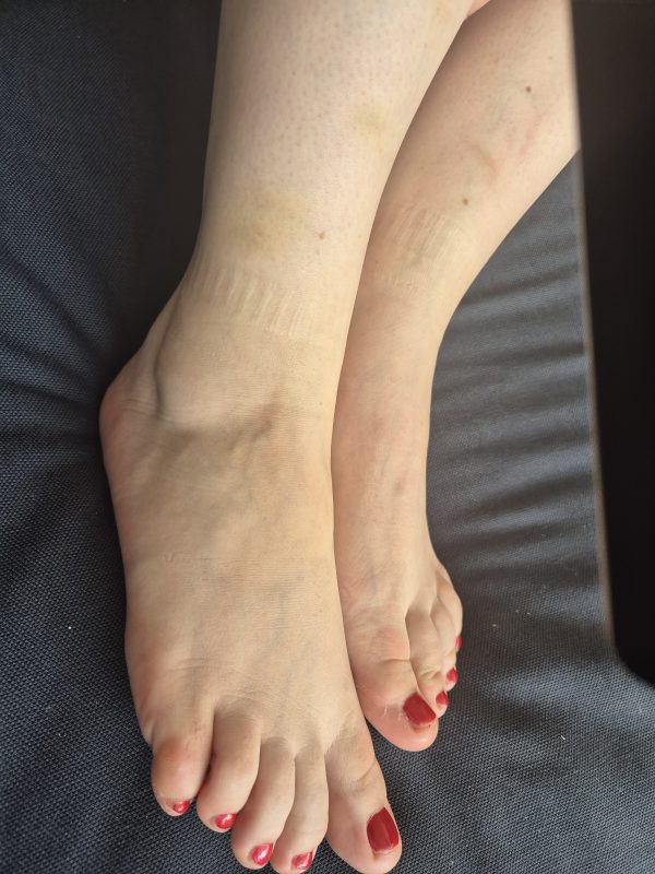 Foot fetish møder