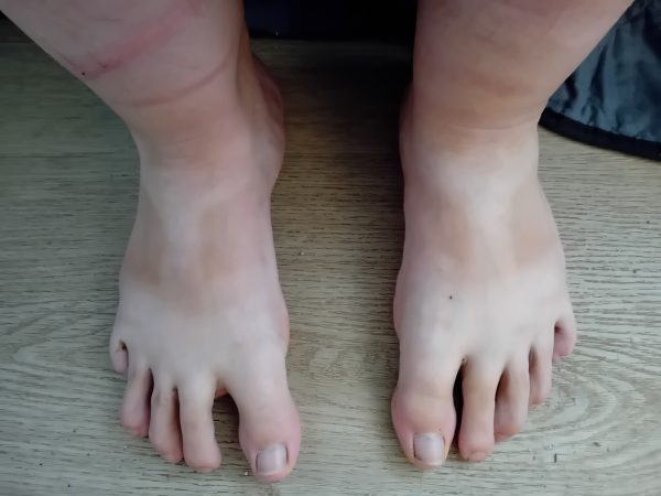 Fod billede