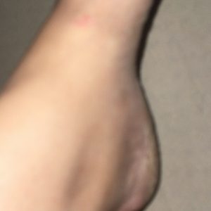 Billede af mine fødder